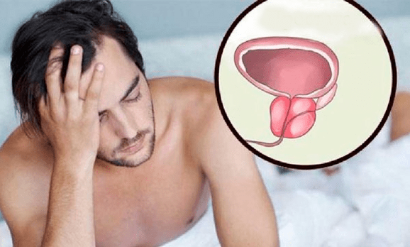 Symptomer vun Prostatitis